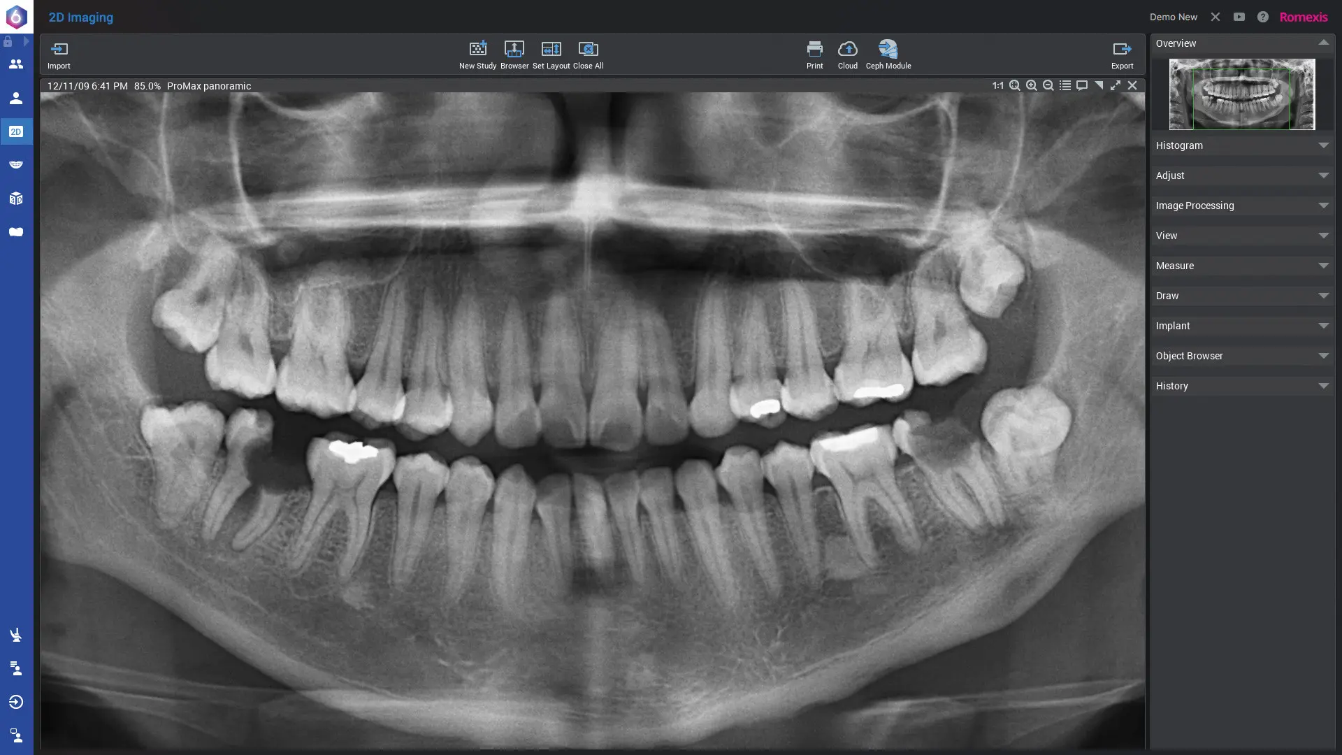 Romexis_Screenshot-2D-Panorama_1920px