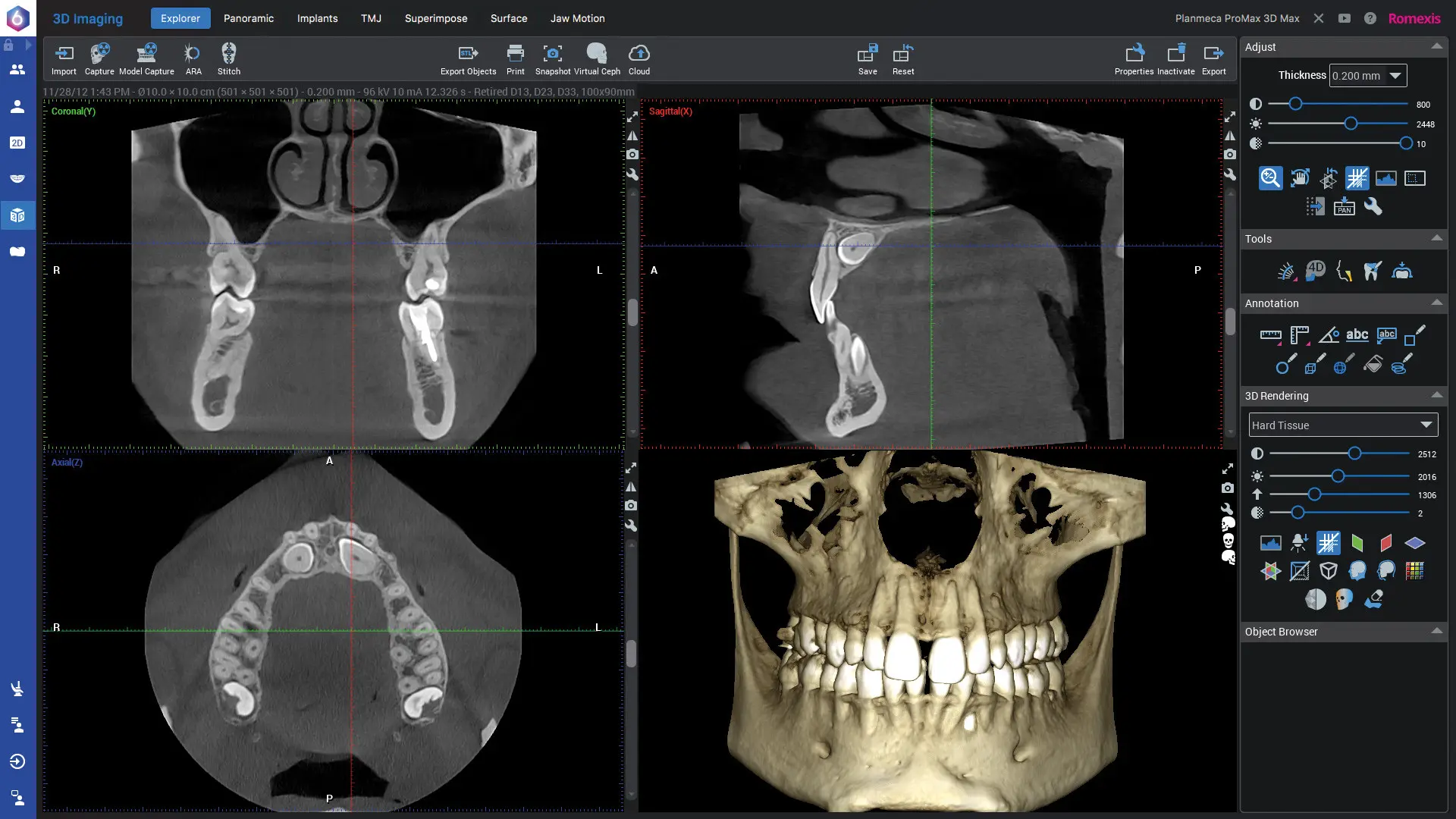 Romexis_Screenshot-DVT_1920px